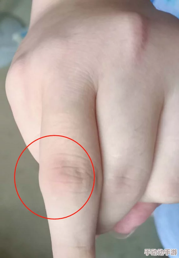 男孩命根子一边硬硬的还通,医生揭示罕见病因及治疗方案,引发广泛关注与讨论 男孩命根子一边硬硬的还通,医生揭示罕见病因及治疗方案,引发广泛关注与讨论